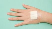 Hand with a transparent adhesive dressing covering a square wound pad on the back of the hand.