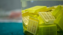 Embedding cassette while the sample process In the biopsy laboratory. Embedding cassette while the sample process In the biopsy laboratory.