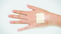 Elastollan TPU woundcare medical technology